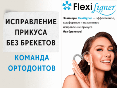 Исправление прикуса без брекетов — элайнеры FlexiLigner